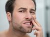 Mitos e verdades sobre manchas nos dentes