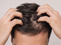 O guia prático do couro cabeludo masculino